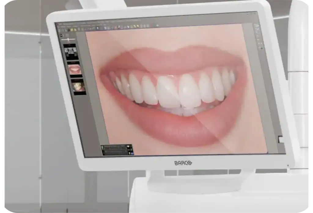 Castellini Puma Eli R - Apex-dental