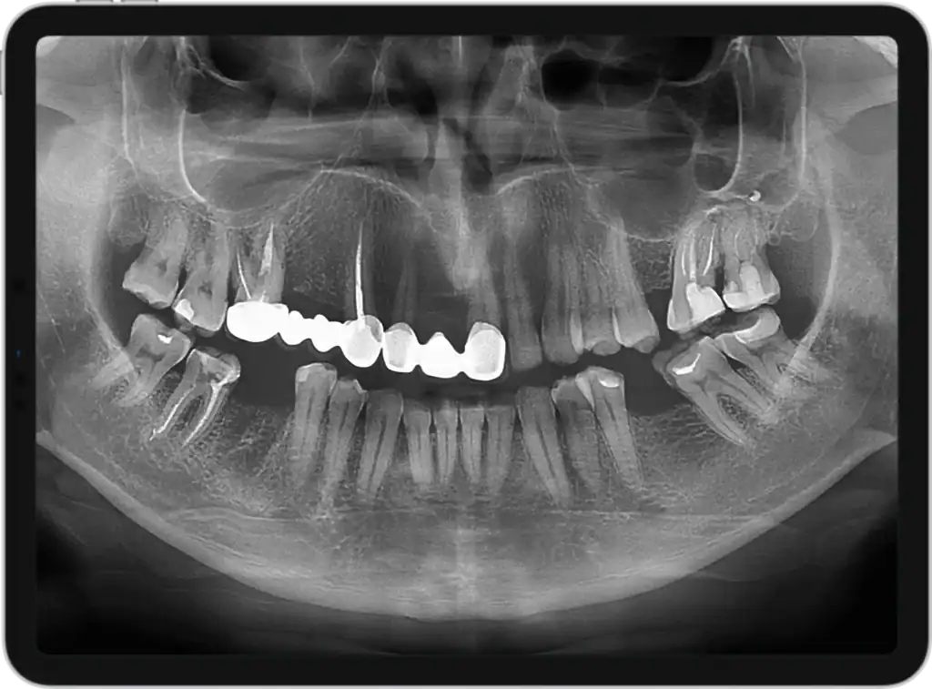 Diplomat Model Pro 500 - Apex-Dental
