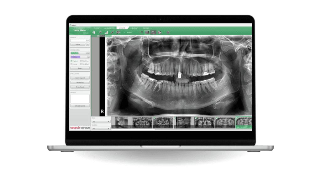 PaX-i™ - Apex-Dental