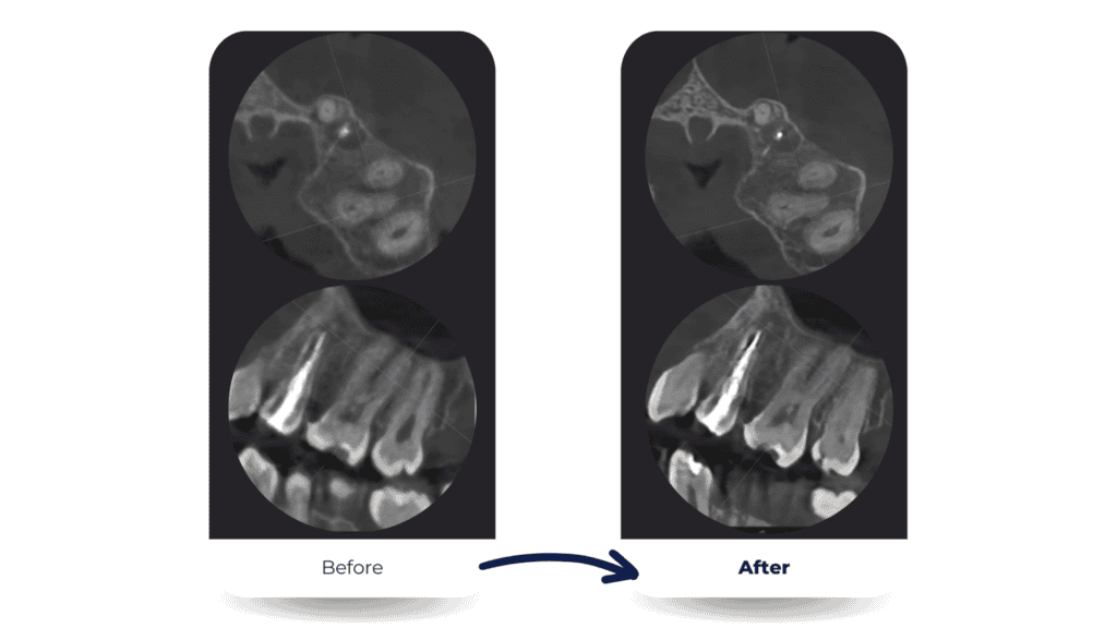 Smart Plus™ · New Edition - Apex-Dental