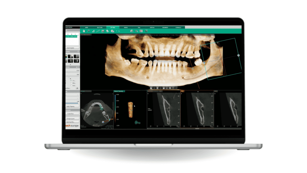 Smart Plus™ · New Edition - Apex-Dental