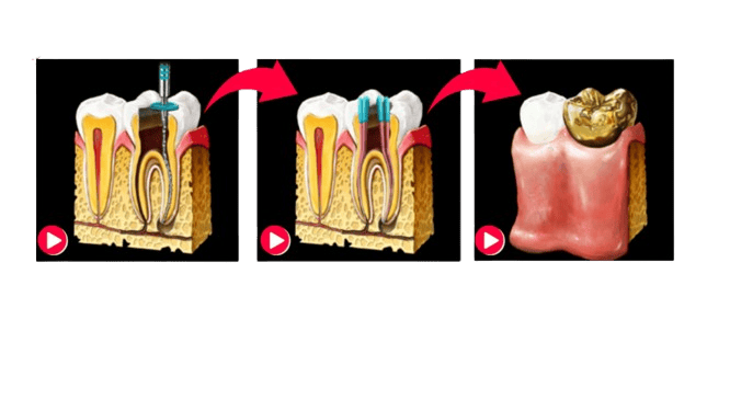 EzSensor™ Classic - Apex-Dental