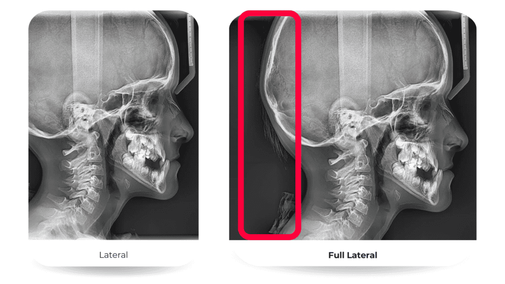 PaX-i™ - Apex-Dental