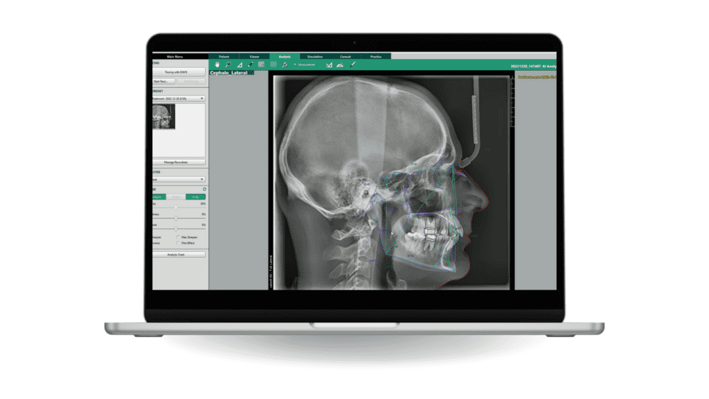 PaX-i™ - Apex-Dental
