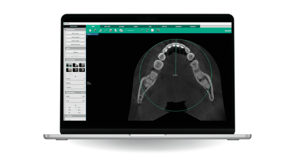 Smart Plus™ · New Edition - Apex-Dental