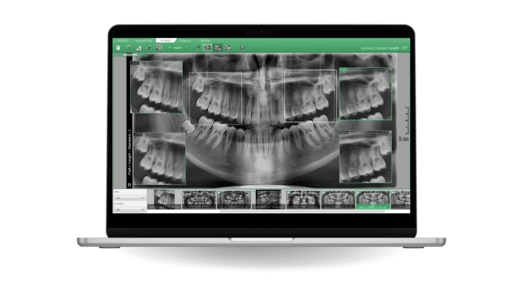 Smart Plus™ · New Edition - Apex-Dental