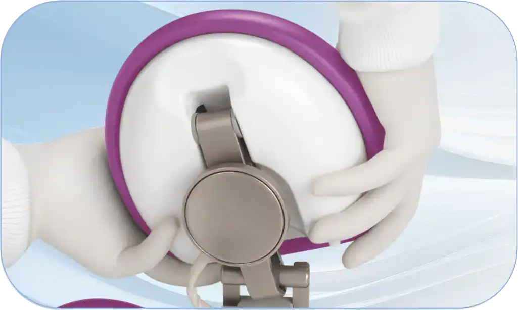 Pneumatikus fejtámla