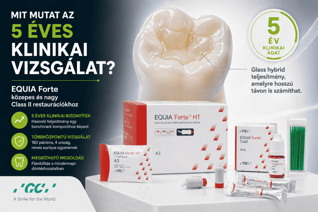 Mit mutat az 5 éves klinikai vizsgálat? EQUIA Forte HT közepes és nagy Class II restaurációkhoz