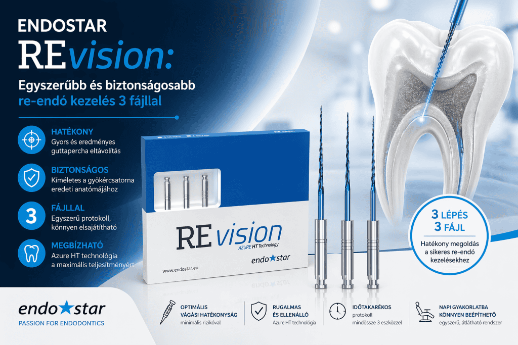 Endostar REvision: egyszerűbb és biztonságosabb re-endó kezelés 3 fájllal