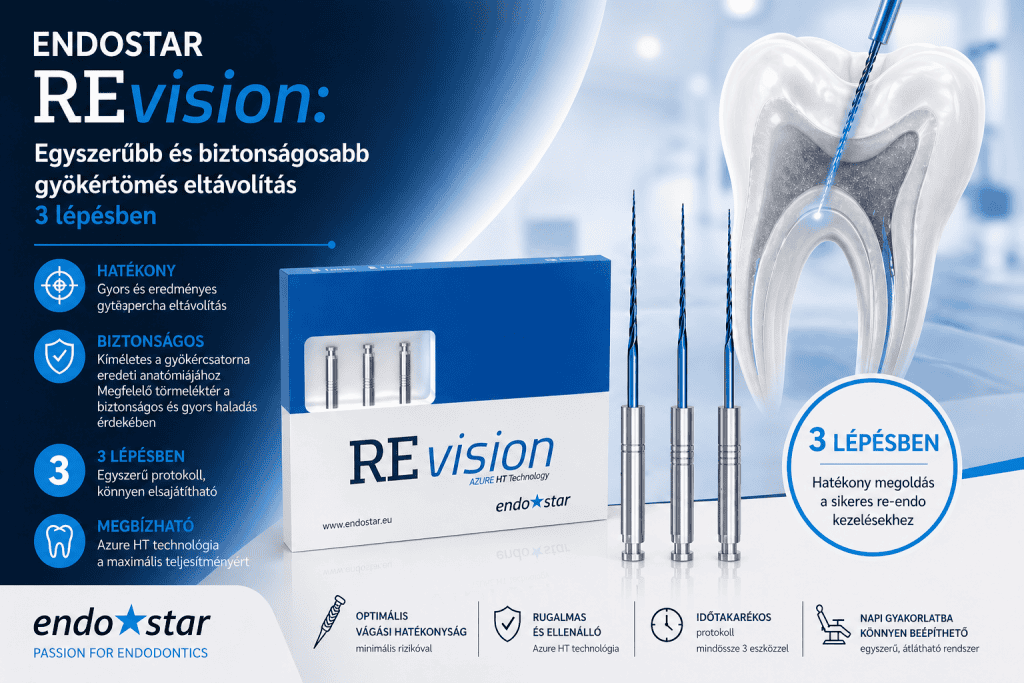 Endostar REvision: egyszerűbb és biztonságosabb gyökértömés eltávolítás három lépesben