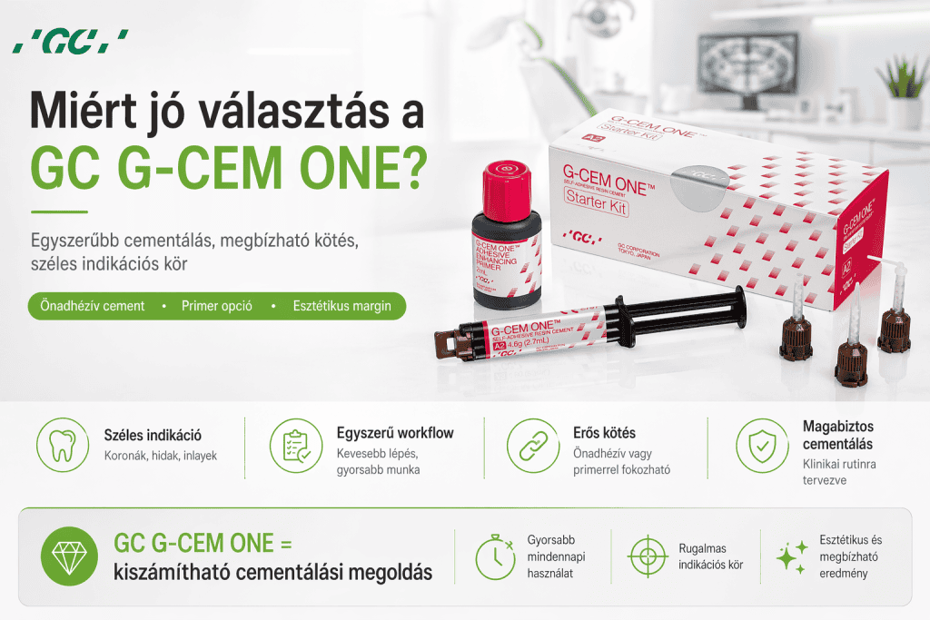 GC G-CEM ONE: univerzális ragasztócement egyszerűbb és biztosabb cementálási workflow-hoz